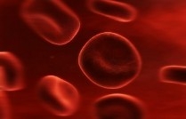 Benzene Exposure: Acute Myelogenous Leukemia