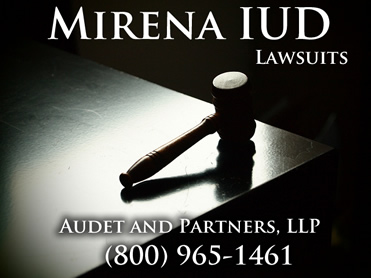 Mirena Lawsuits